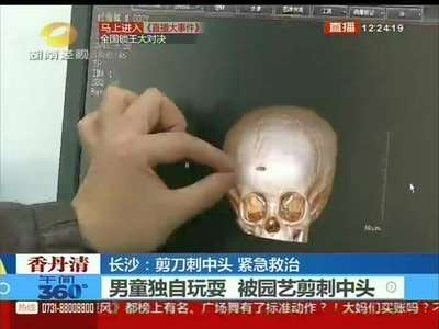 长沙：男童遭园艺剪刺中头 紧急救治