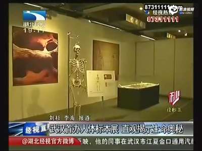 [视频]武汉首办人体标本展 所展样品均来自真实人体
