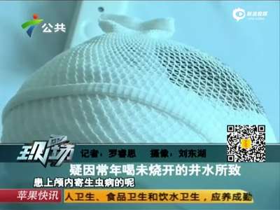 [视频]孕妇时常莫名抽搐麻木 脑袋里取出8厘米白色虫  