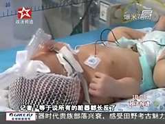 [视频]东莞现“镜面人”五脏六腑位置与常人相反