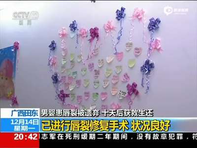 [视频]唇裂男婴被遗弃荒郊两天被埋8天后获救奇迹生还