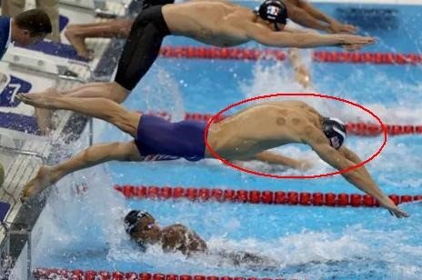 奥运带火拔罐 中医:运动员年轻气盛拔罐可“泄气”