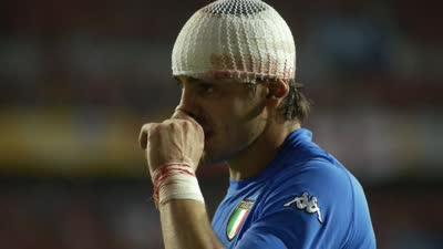 02年的韩国人有多脏?意大利男模被殴至满脸是