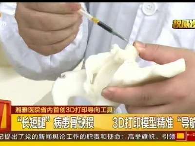 湘雅医院省内首创3D打印导向工具