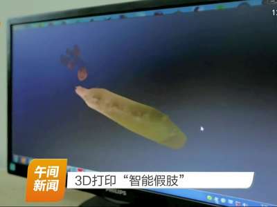 3D打印“智能假肢”
