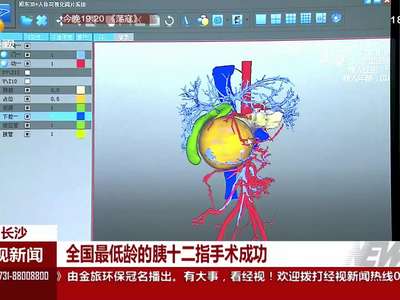 全国最低龄的胰十二指手术成功
