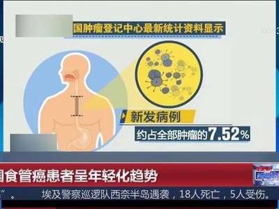 [视频]我国食管癌患者呈年轻化趋势