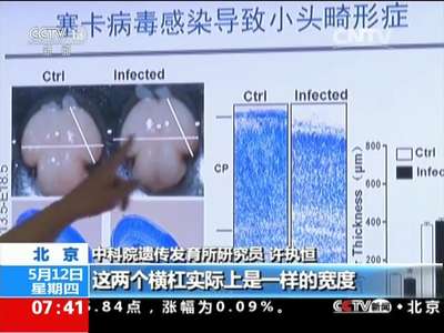 [视频]我国科学家取得寨卡病毒研究新突破：证实寨卡病毒感染直接致小头畸形