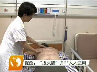 中国“拔火罐”风靡奥运赛场