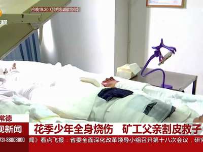 花季少年全身烧伤 矿工父亲割皮救子