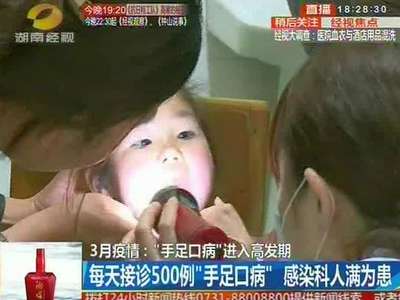 “手足口病”进入高发期 每天接诊500例